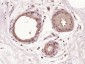 ESE1 Polyclonal Antibody